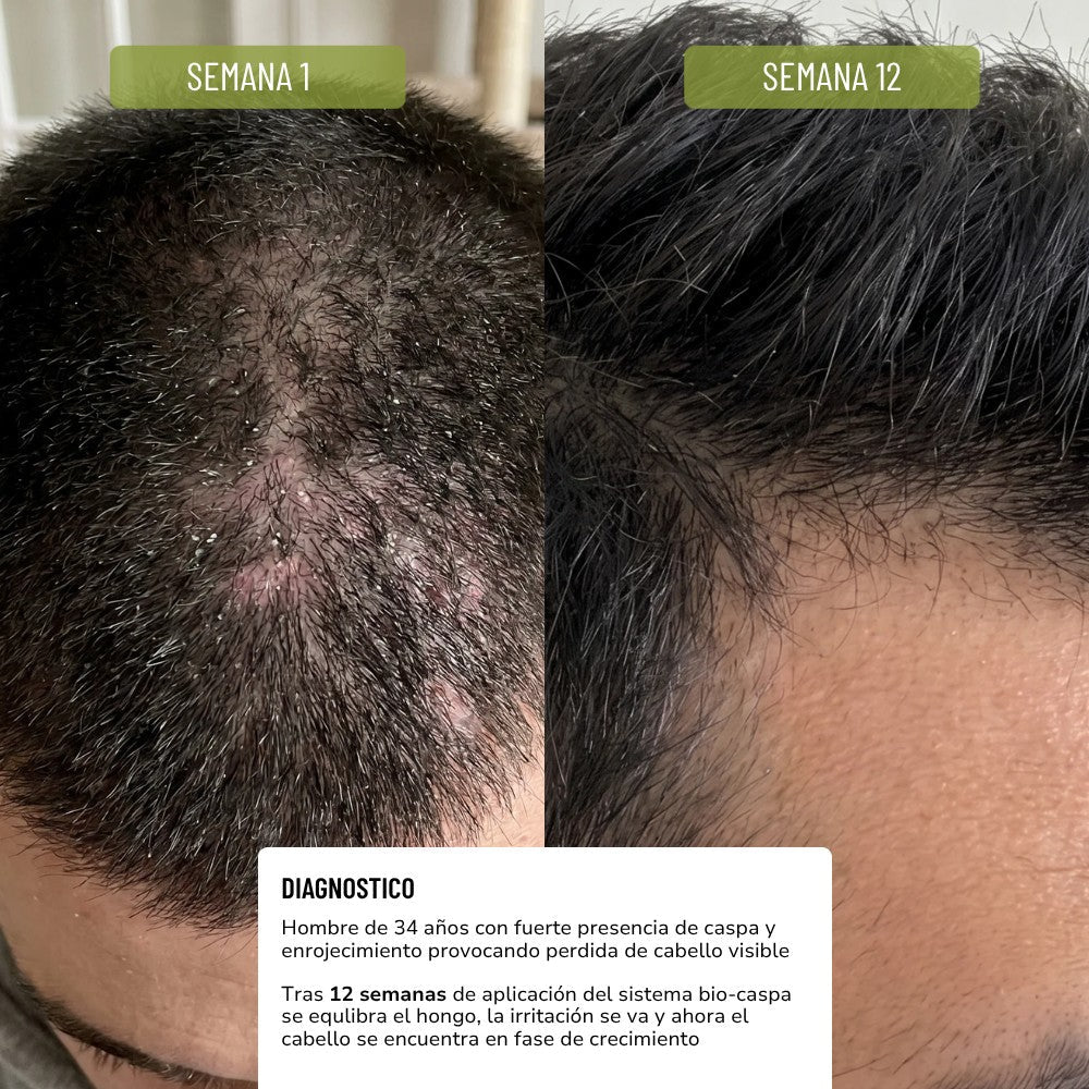 Bio Caspa Ritual Kit